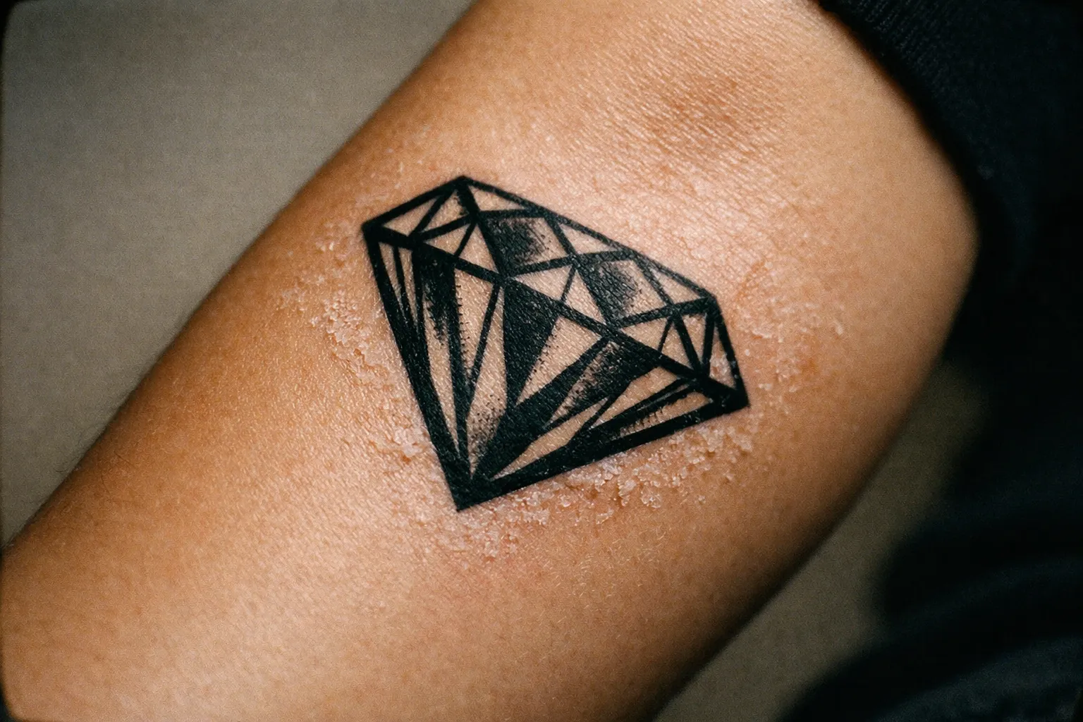Forearm diamond tattoo mid-healing with light flaking