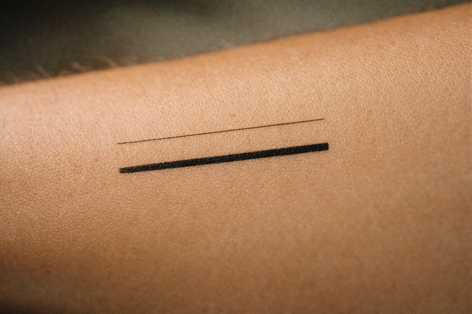 Forearm close-up showing two line widths illustrating different needle sizes without text