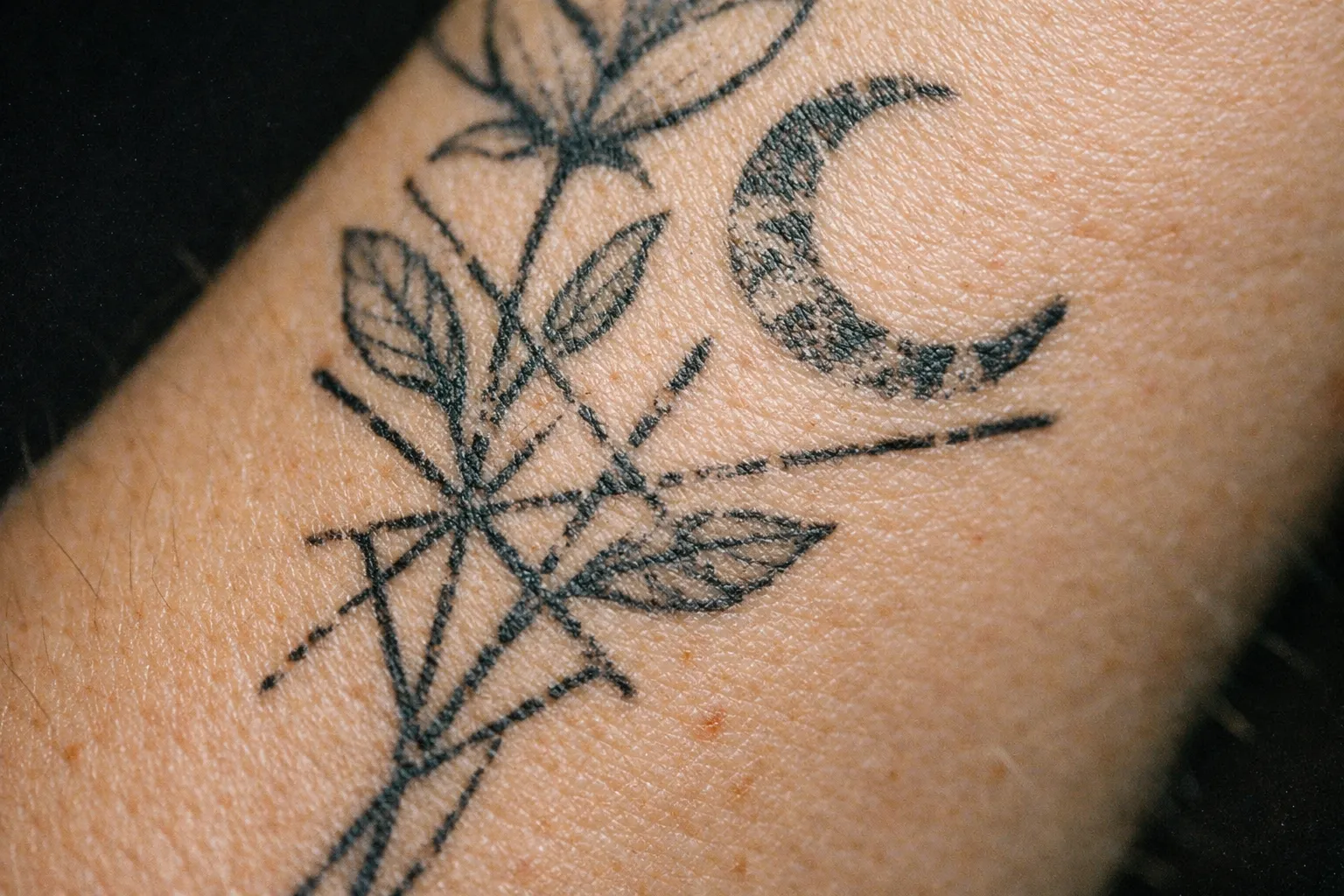Forearm tattoo with mild redness around ink after laser treatment