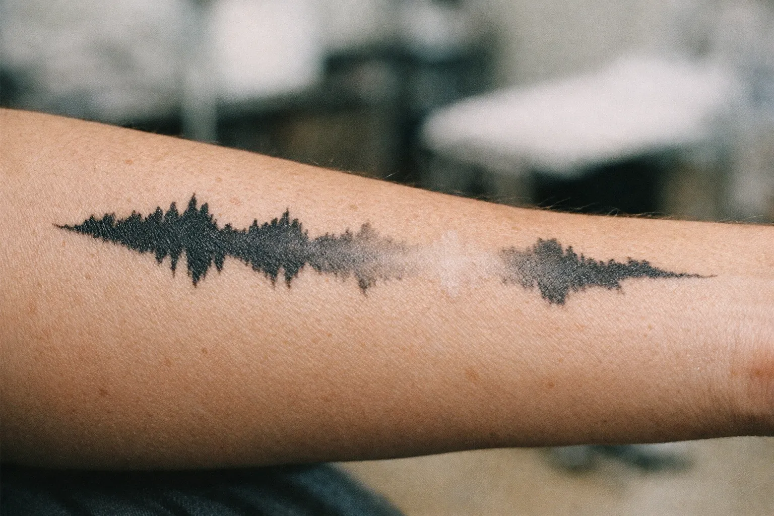 Forearm tattoo showing fading patches along the ink to imply evaluating provider options